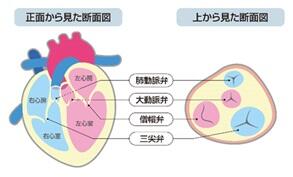 心臓弁膜症_1.jpg